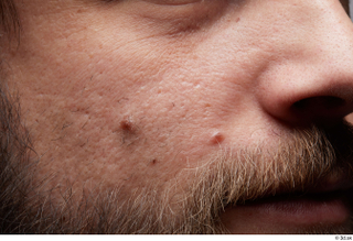  HD Face Skin Arron Cooper cheek face nose skin pores skin texture wrinkles 0001.jpg